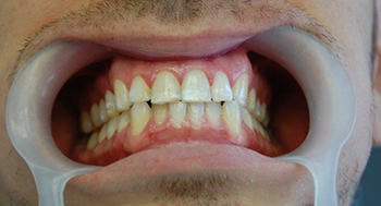 609_34c9c7baf5afcddf4e236d95c56fbffa.jpg